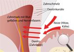 Schmerzempfindliche Zähne Schmerzempfindliche Zähne