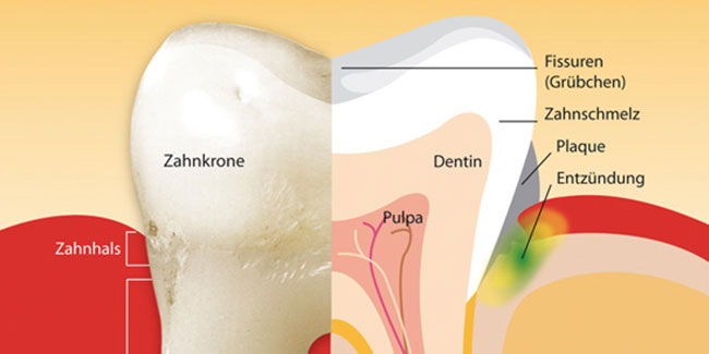 Parodontitisbehandlung